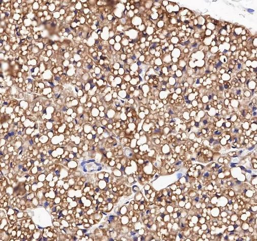 Recombinant FABP4 Monoclonal Antibody (AGEL6706)