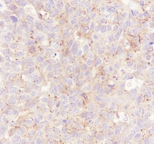 Recombinant ALIX Monoclonal Antibody (AGEL6712)
