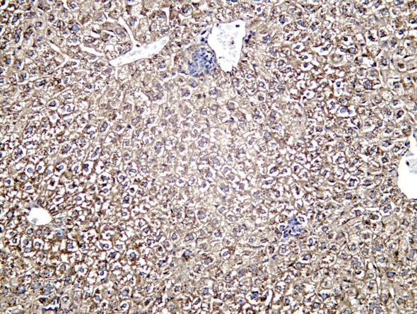 Recombinant Prothrombin Monoclonal Antibody (AGEL6714)