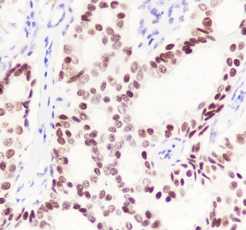 Recombinant GATA3 Monoclonal Antibody (AGEL6719)