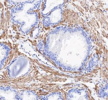 Recombinant Alpha Skeletal Muscle Actin Monoclonal Antibody (AGEL6724)