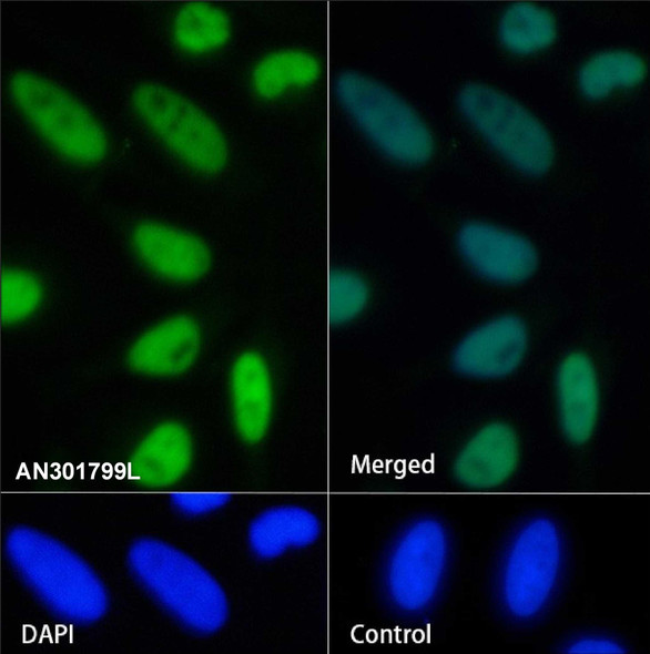 Recombinant SMARCD1 Monoclonal Antibody (AGEL6726)