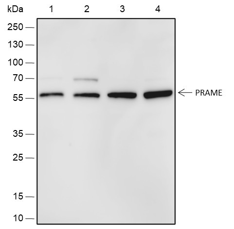Recombinant PRAME Monoclonal Antibody (AGEL6728)