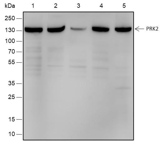 Recombinant PRK2 Monoclonal Antibody (AGEL6730)