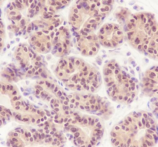 Recombinant MTAP Monoclonal Antibody (AGEL6734)