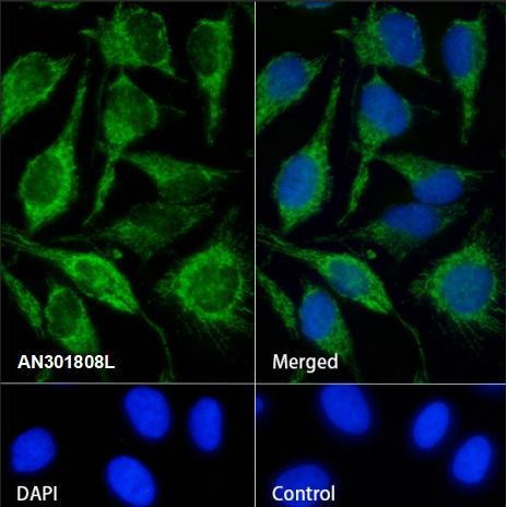 Recombinant PDHA1 Monoclonal Antibody (AGEL6735)