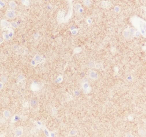 Recombinant GABA A Receptor alpha 1 Monoclonal Antibody (AGEL6738)