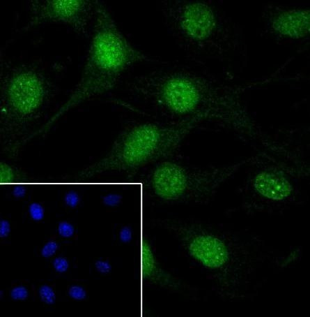 Recombinant Casein Kinase 2 beta Monoclonal Antibody (AGEL6747)