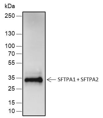 Recombinant SFTPA1+SFTPA2 Monoclonal Antibody (AGEL6749)