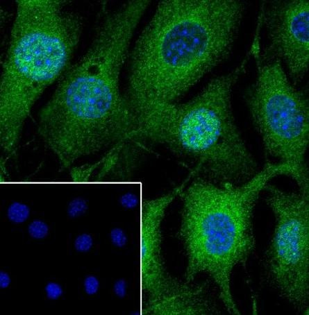 Recombinant NF-kB2 p100/p52 Monoclonal Antibody (AGEL6753)