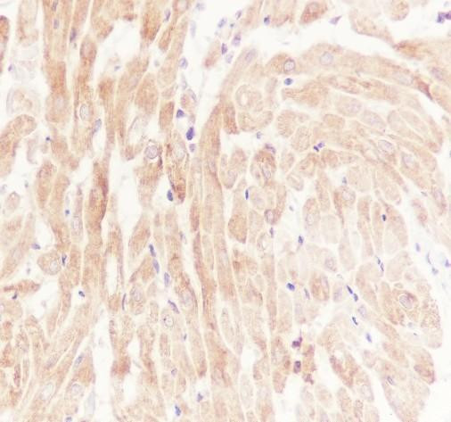 Recombinant NF-kB2 p100/p52 Monoclonal Antibody (AGEL6753)