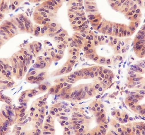 Recombinant Cyclin D2 Monoclonal Antibody (AGEL6757)