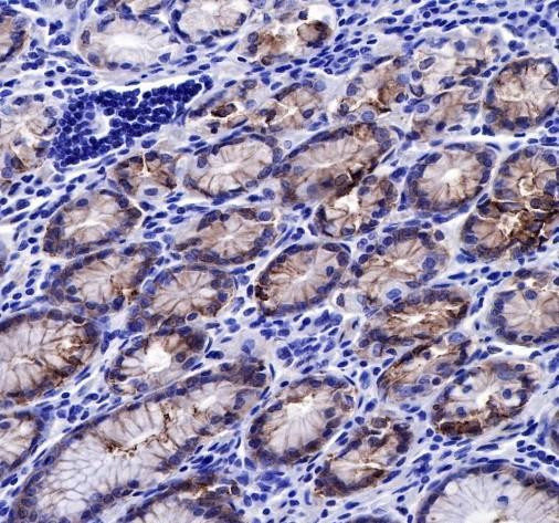 Recombinant Claudin 18.2 Monoclonal Antibody (AGEL6758)
