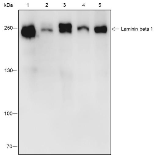 Recombinant Laminin beta 1 Monoclonal Antibody (AGEL6760)