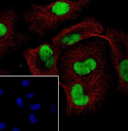 Recombinant AKT1+AKT2+AKT3 Monoclonal Antibody (AGEL6764)