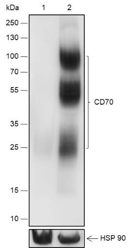 Recombinant CD70 Monoclonal Antibody (AGEL6765)