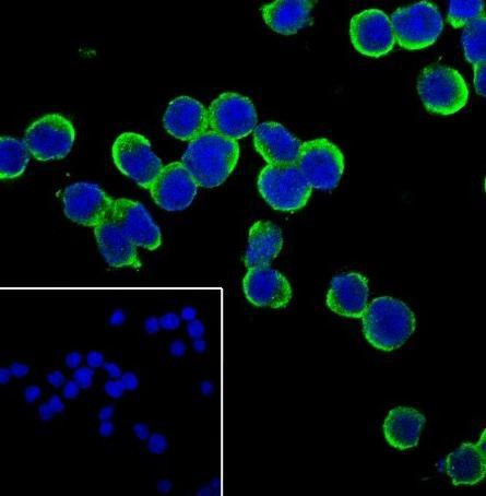 Recombinant IL-4 Monoclonal Antibody (AGEL6769)