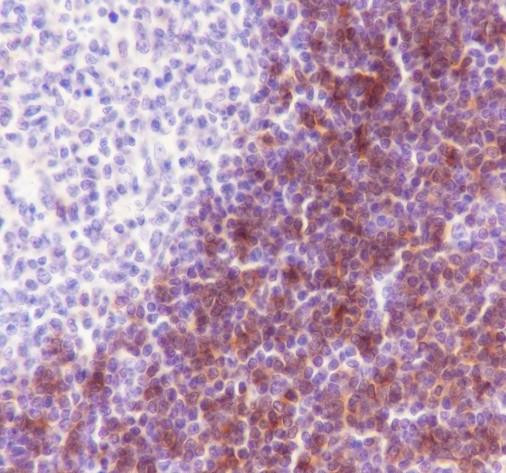 Recombinant CD1c Monoclonal Antibody (AGEL6770)