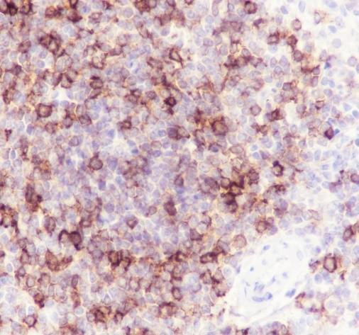 Recombinant CD1c Monoclonal Antibody (AGEL6770)