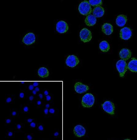 Recombinant CD42b Monoclonal Antibody (AGEL6772)