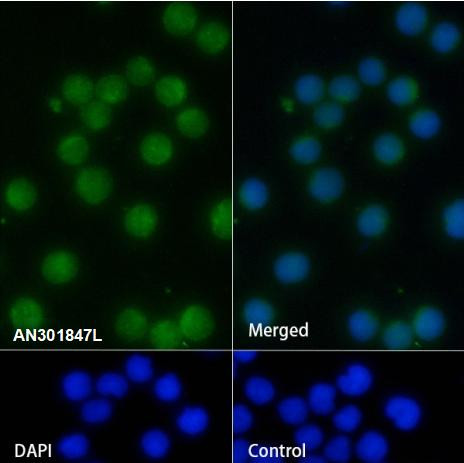 Recombinant Kappa light chain Monoclonal Antibody (AGEL6774)