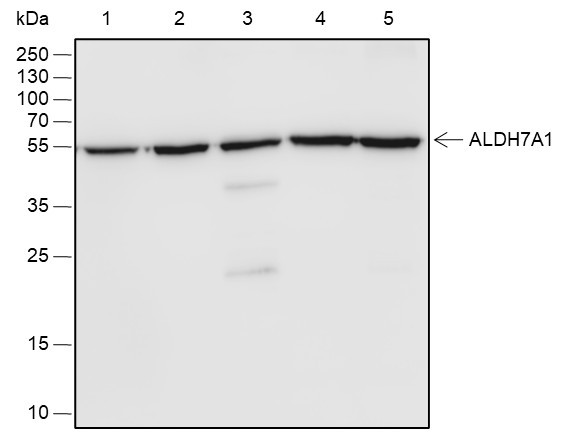 Recombinant ALDH7A1 Monoclonal Antibody (AGEL6775)
