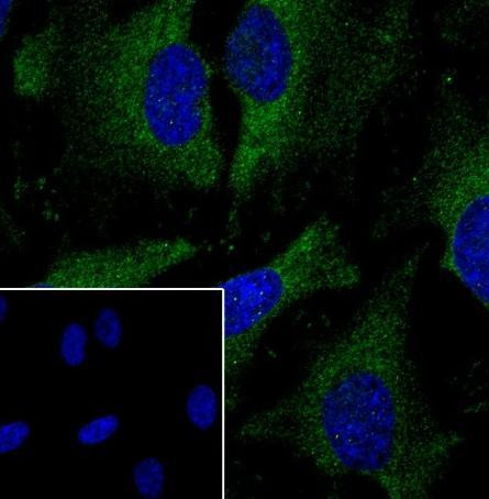 Recombinant IKB beta Monoclonal Antibody (AGEL6778)