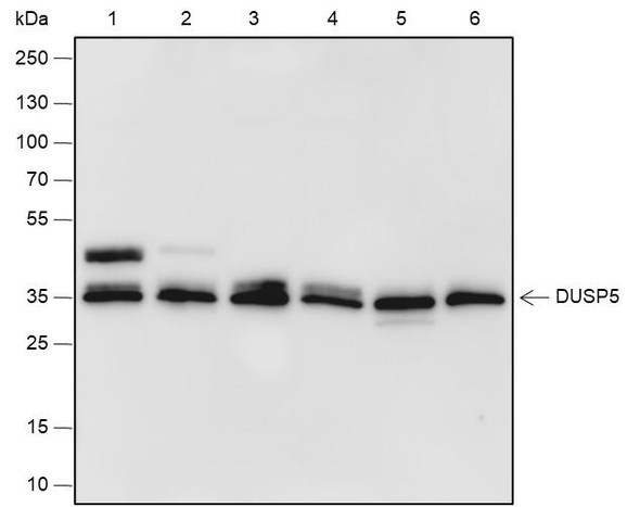 Recombinant DUSP5 Monoclonal Antibody (AGEL6780)