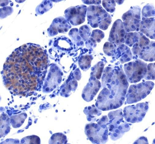 Recombinant IRAK1 Monoclonal Antibody (AGEL6782)