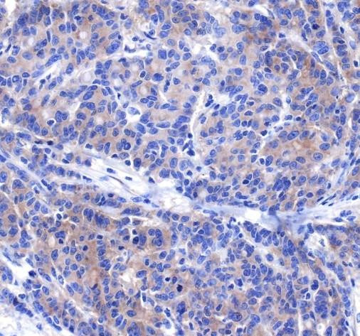 Recombinant DR5 Monoclonal Antibody (AGEL6783)