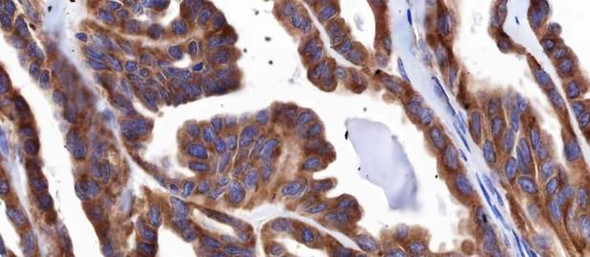 Recombinant IGF2R/CI-M6PR Monoclonal Antibody (AGEL6786)