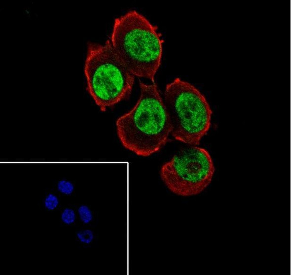 Recombinant QKI Monoclonal Antibody (AGEL6790)