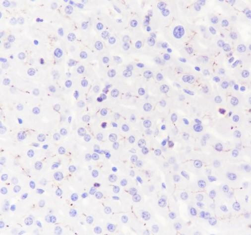 Recombinant Glypican-3 Monoclonal Antibody (AGEL6792)