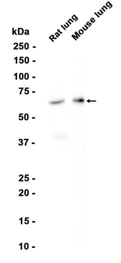 Recombinant MMP8 Monoclonal Antibody (AGEL6794)