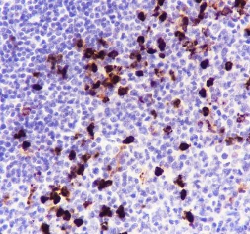 Recombinant Lysozyme Monoclonal Antibody (AGEL6795)