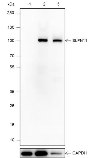 Recombinant SLFN11 Monoclonal Antibody (AGEL6797)