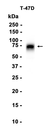 Recombinant B7-H4 Monoclonal Antibody (AGEL6803)