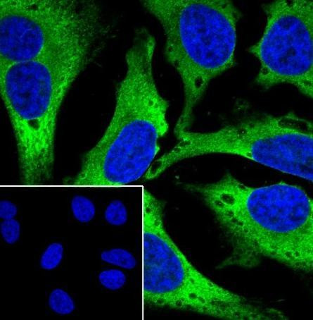 Recombinant DDX3 Monoclonal Antibody (AGEL6805)