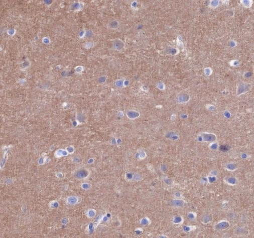 Recombinant Bcr Monoclonal Antibody (AGEL6806)