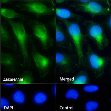 Recombinant beta II Tubulin Monoclonal Antibody (AGEL6807)