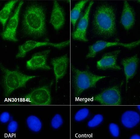 Recombinant UQCRFS1/RISP Monoclonal Antibody (AGEL6810)