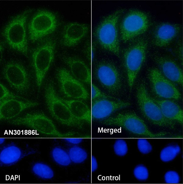 Recombinant SHIP-1 Monoclonal Antibody (AGEL6812)