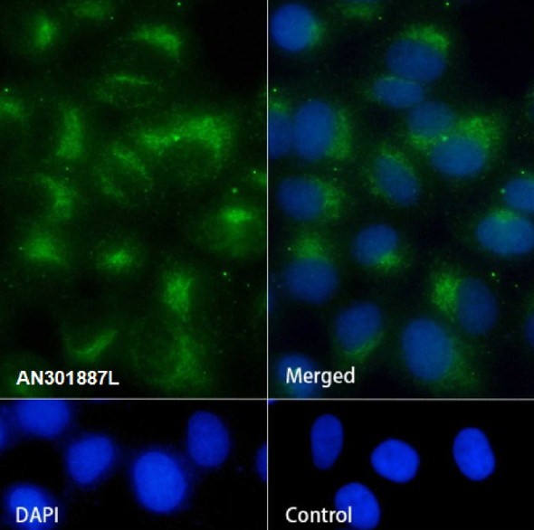 Recombinant TMEM192 Monoclonal Antibody (AGEL6813)