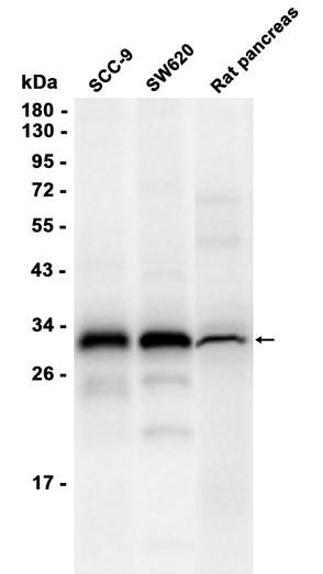 Recombinant TMEM192 Monoclonal Antibody (AGEL6813)