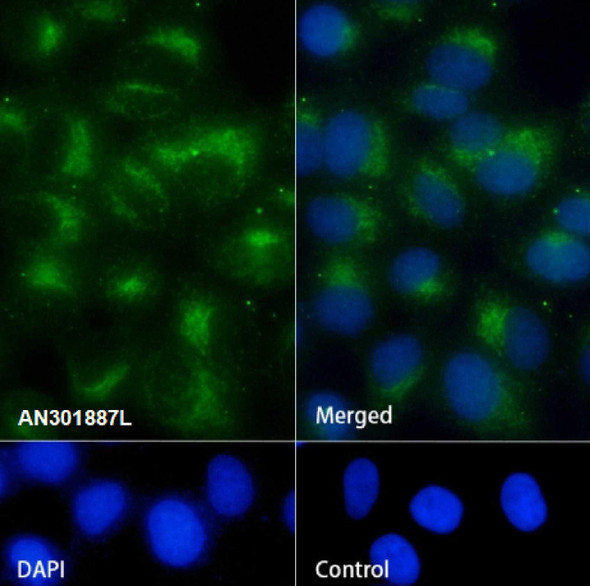 Recombinant TMEM192 Monoclonal Antibody (AGEL6813)