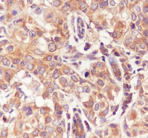 Recombinant TNF receptor II Monoclonal Antibody (AGEL6814)
