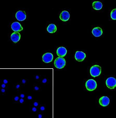 Recombinant TNF receptor II Monoclonal Antibody (AGEL6814)