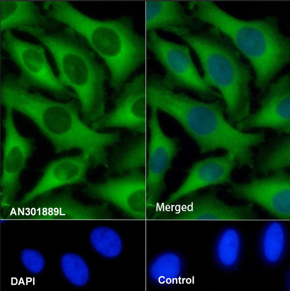Recombinant KIF5B Monoclonal Antibody (AGEL6815)