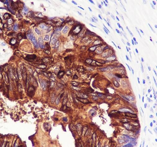 Recombinant TFF1/pS2 Monoclonal Antibody (AGEL6818)