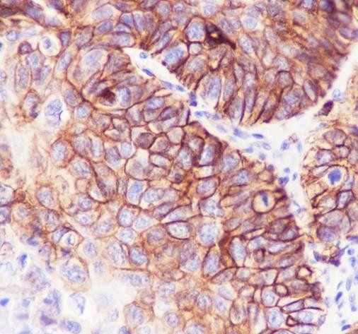 Recombinant SLC7A5/LAT1 Monoclonal Antibody (AGEL6823)